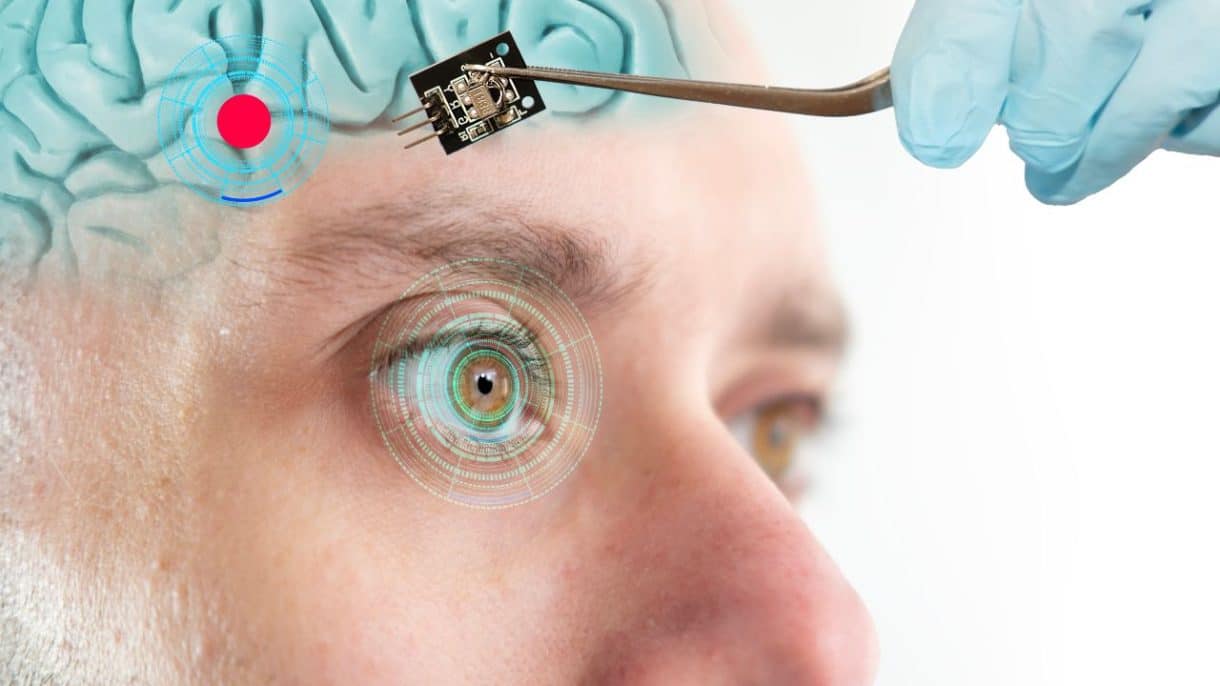 Implante cerebral que estimula neuronas para crear visión