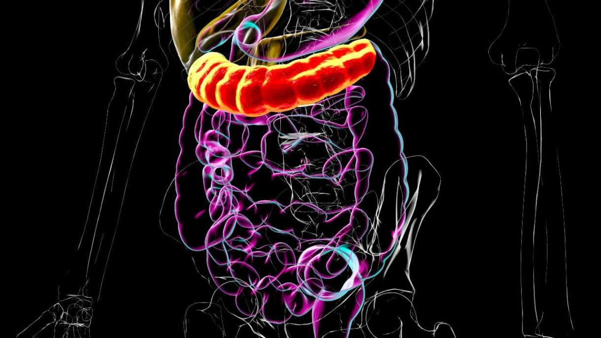 Ilustración del intestino grueso resaltando el colon