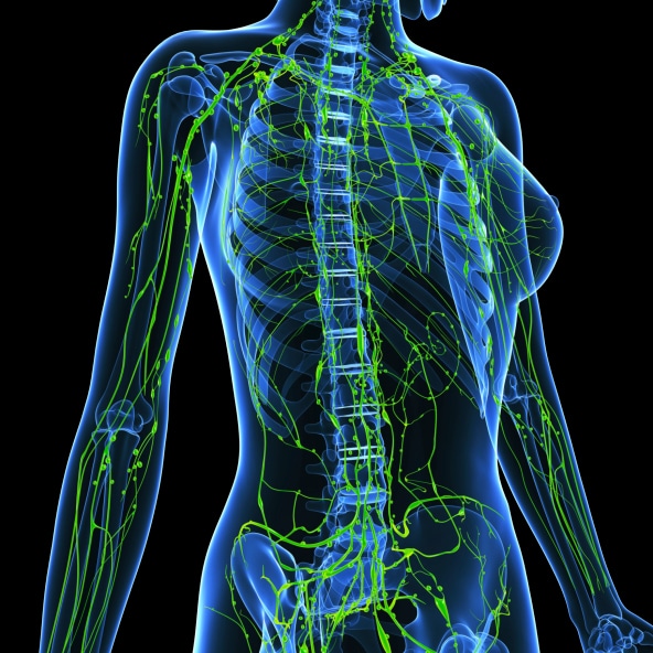 linfedema