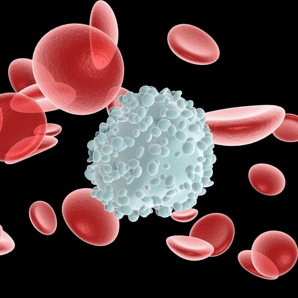 neutropenia