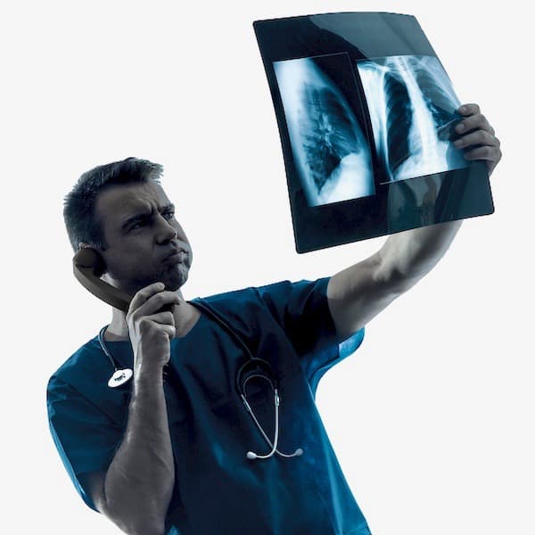nódulos pulmonares