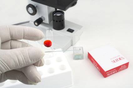 Si eres VIH positivo, pregunta si también tienes el Virus de la Hepatitis C (VHC)