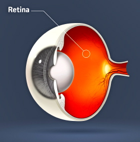 La pérdida visual puede deberse a la retinitis pigmentaria. ¿Sabes qué es?