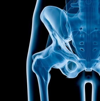 ¿Por cuánto tiempo debes tomar biofosfonatos para la osteoporosis?
