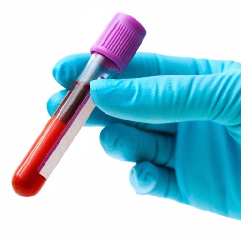 ¿Deberías hacerte la prueba de la diabetes?
