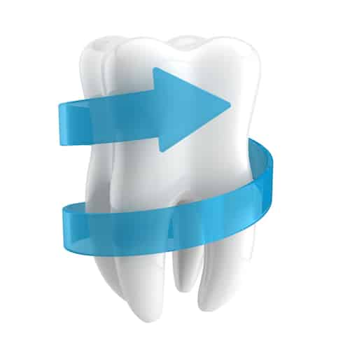 Evita las caries con los selladores dentales