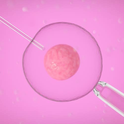fertilización in vitro
